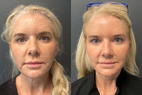 skinvive-3a skinvive-3a