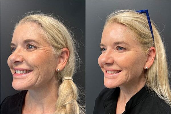 skinvive-3b skinvive-3b